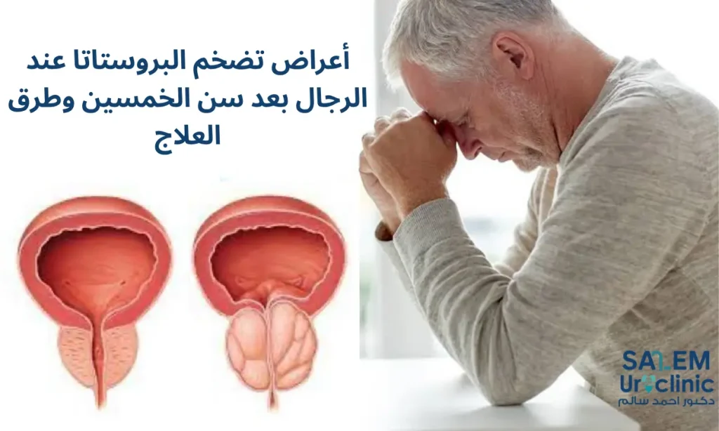 أعراض تضخم البروستاتا عند الرجال بعد سن الخمسين