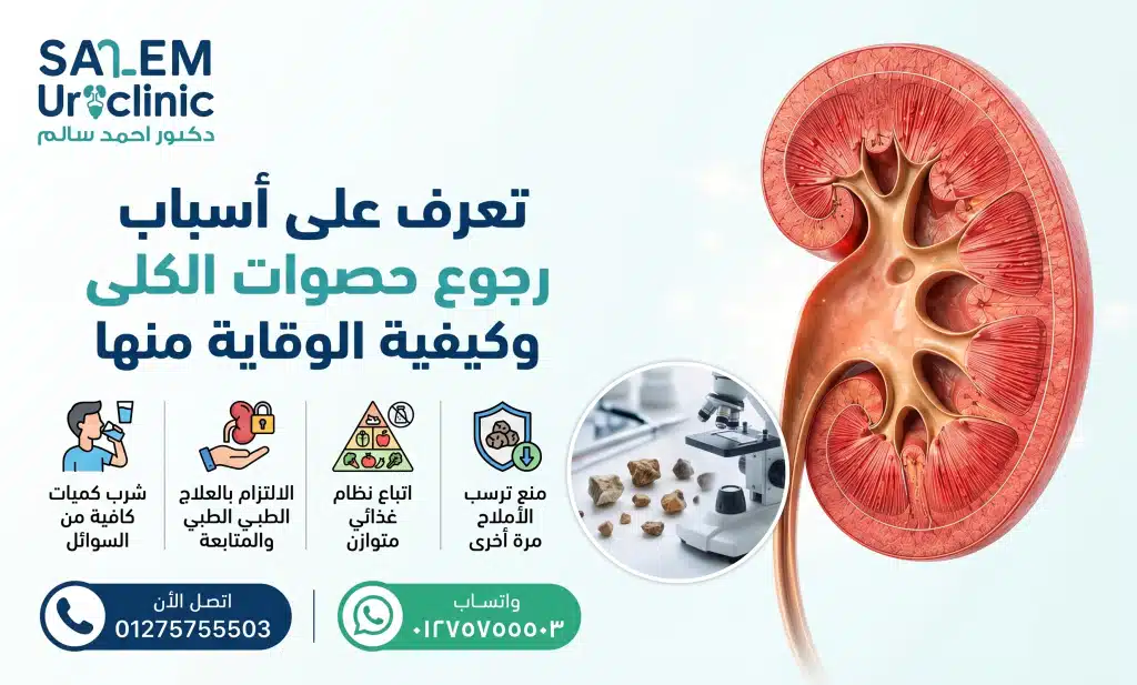 أسباب رجوع حصوات الكلى بعد التفتيت