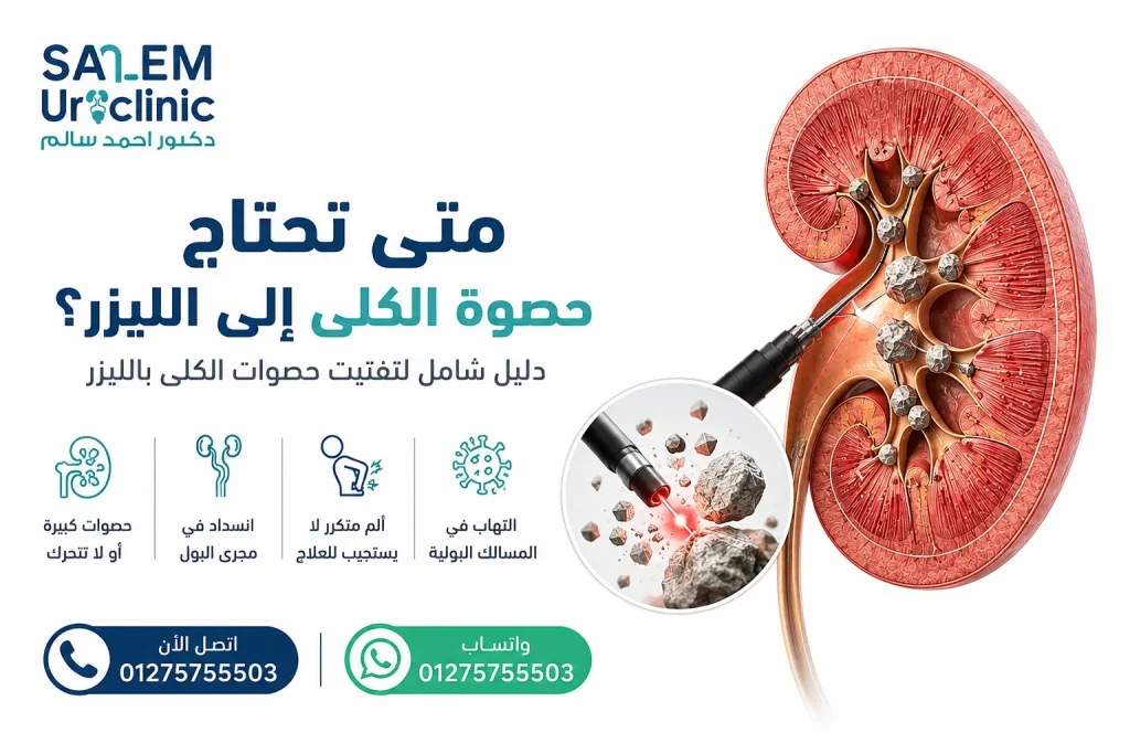 متى تحتاج حصوة الكلى إلى الليزر