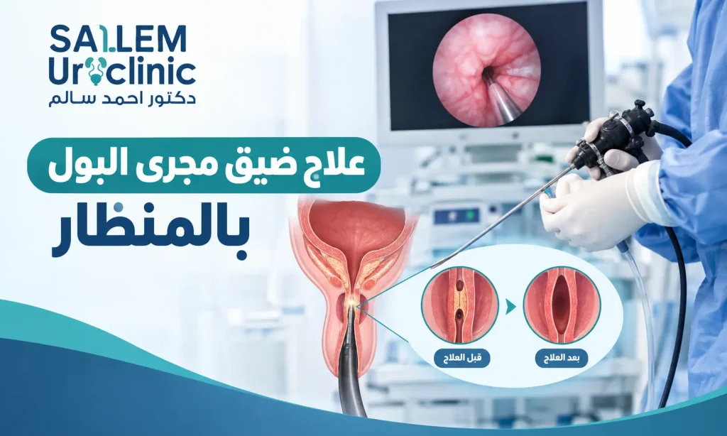 علاج ضيق مجرى البول بالمنظار